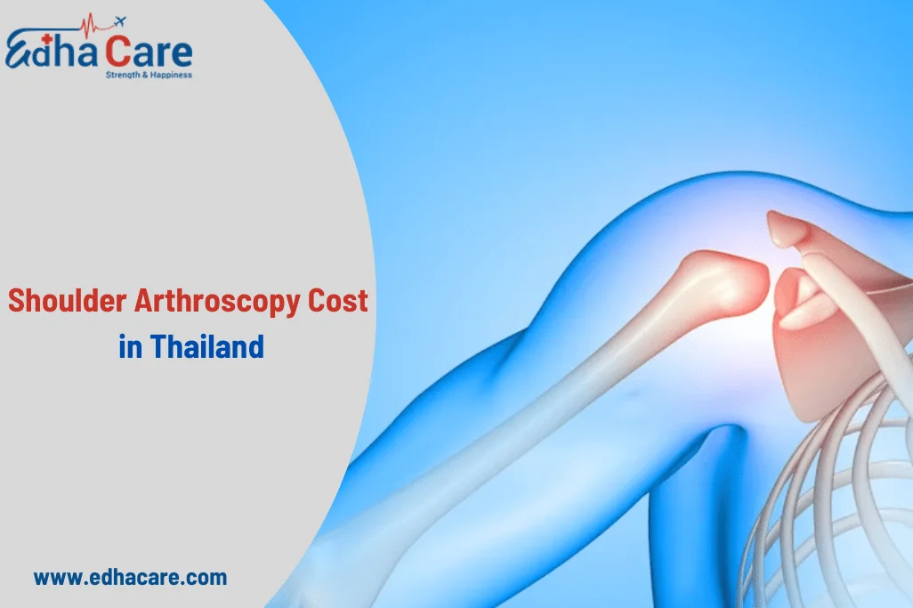 ការចំណាយលើស្មា Arthroscopy នៅប្រទេសថៃ