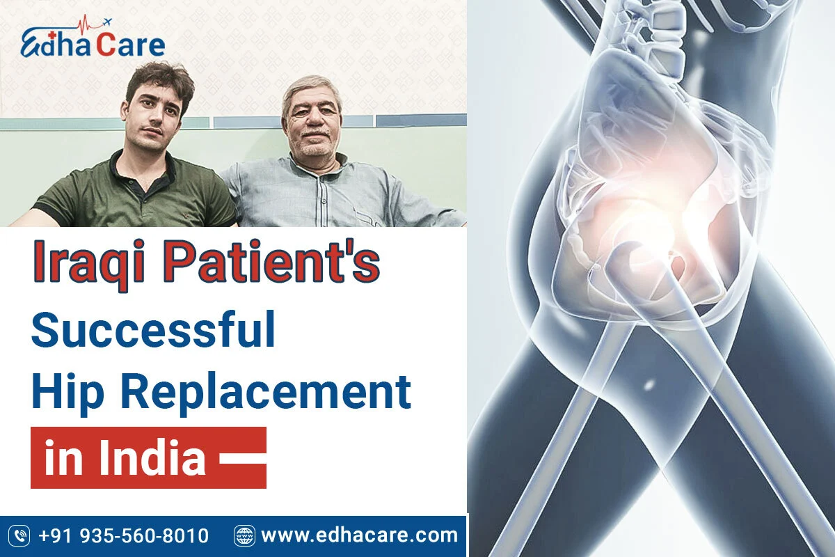 Cirurgia de substituição de quadril bem-sucedida de um paciente iraquiano na Índia