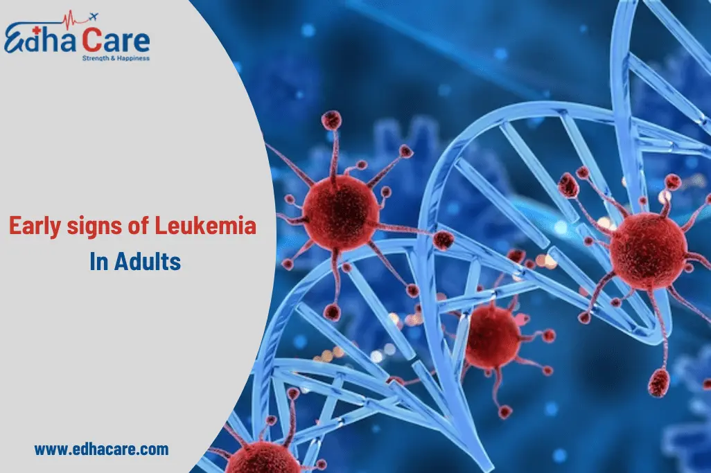 early signs of Leukemia In Adults