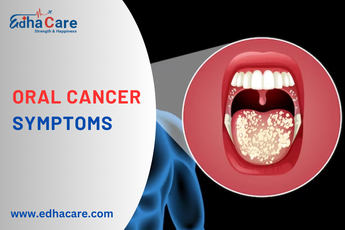 Síntomas del cáncer bucal