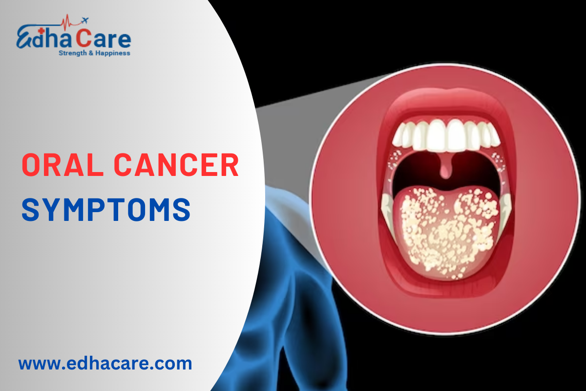 Oral Cancer Symptoms