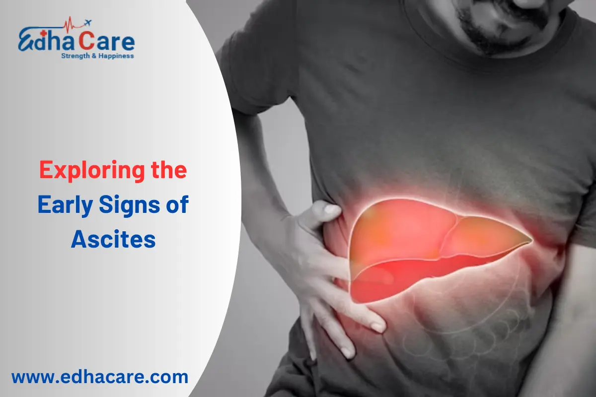 Uncovering the Early Stage Ascites Symptoms