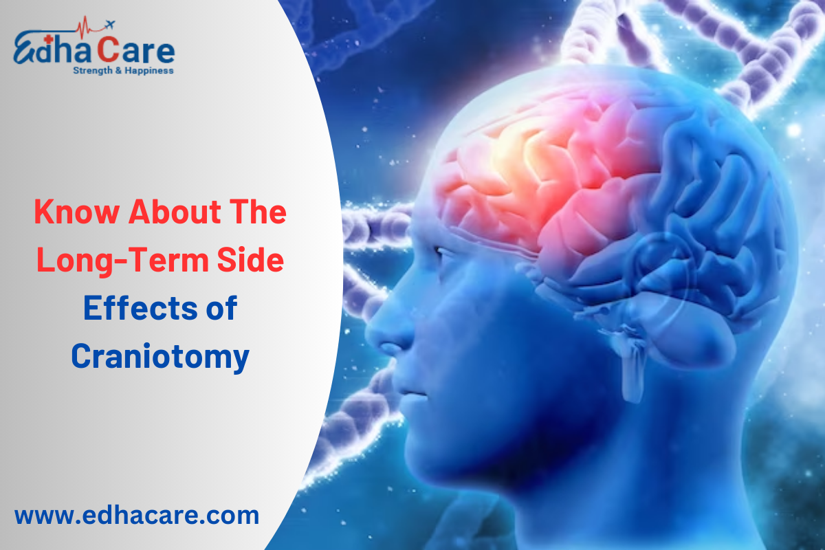 Do You Know About The Long-Term Side Effects of Craniotomy?