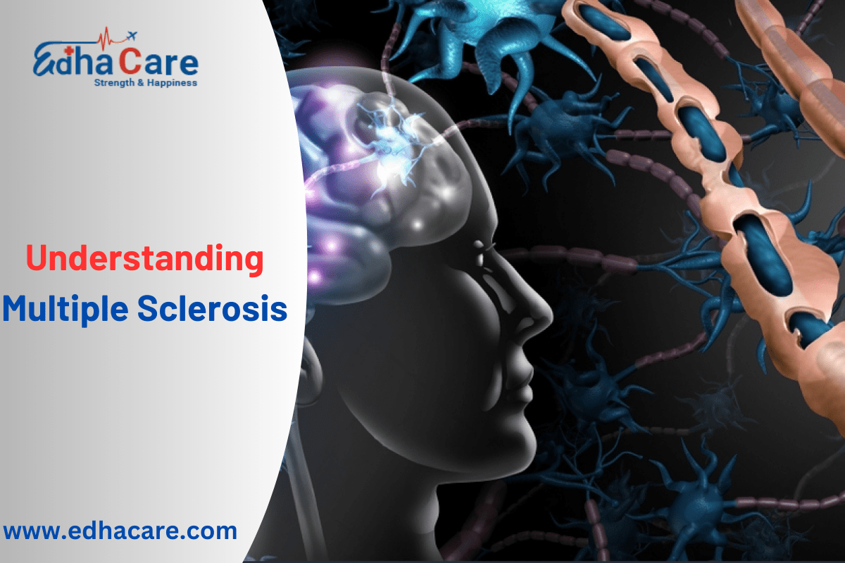 Decodificando la esclerosis múltiple: tipos, síntomas y estrategias de tratamiento