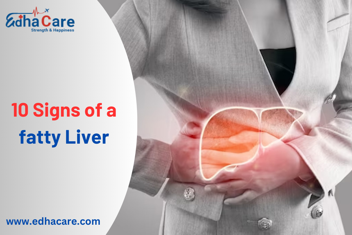 10 Signs of a fatty Liver