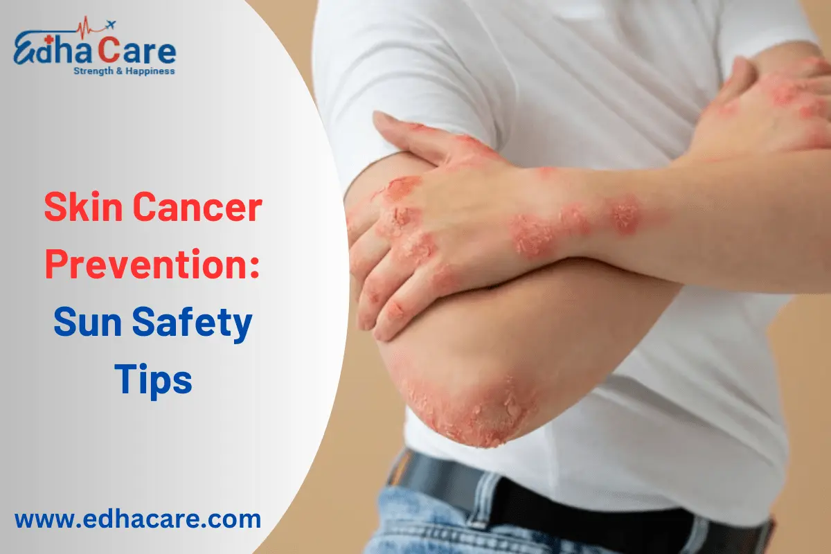 Prevenirea cancerului de piele: sfaturi de siguranță la soare