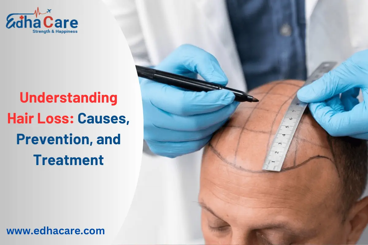 آشنایی با ریزش مو: علل، پیشگیری و درمان