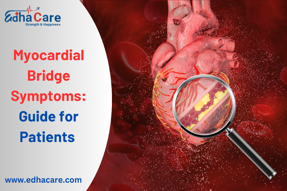 Breaking Down Myocardial Bridge Symptoms: A Comprehensive Guide for Patients