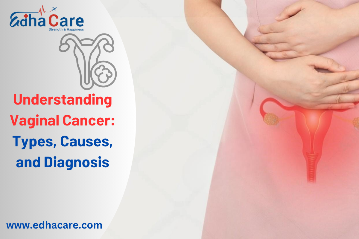 Understanding Vaginal Cancer: Types, Causes, and Diagnosis