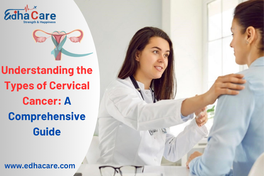 Understanding the Types of Cervical Cancer: A Comprehensive Guide