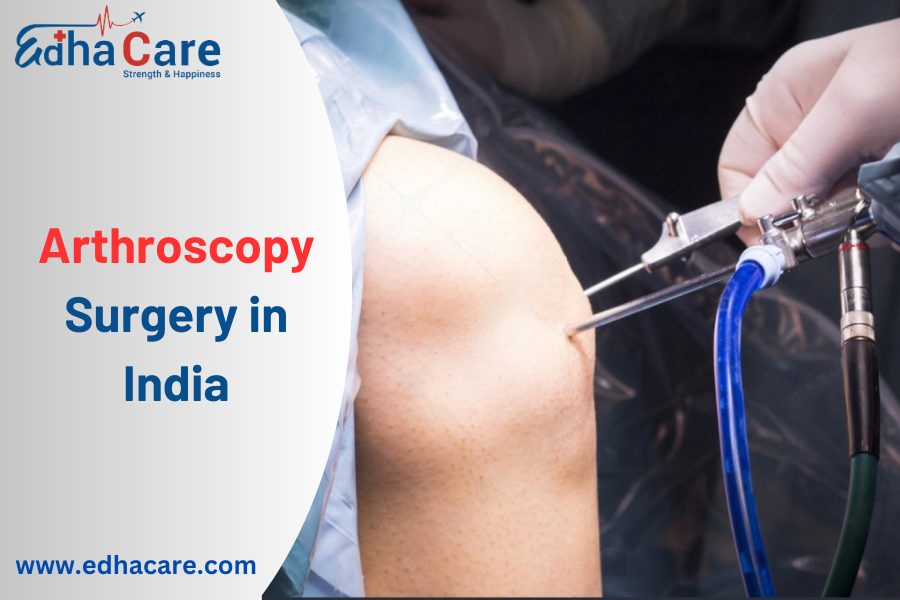 Chirurgie arthroscopique en Inde : un guide complet