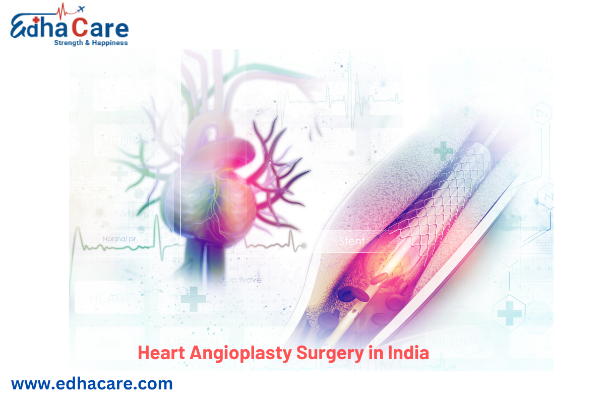 Heart Angioplasty Surgery in India