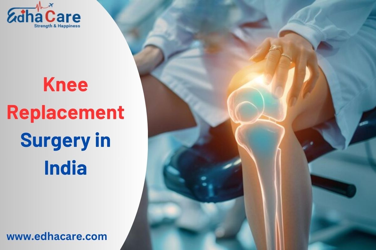 Knee Replacement Surgery in India