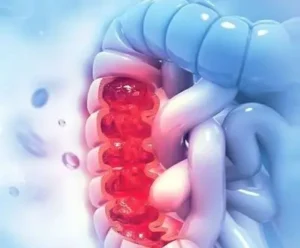 symptoms of anal cancer