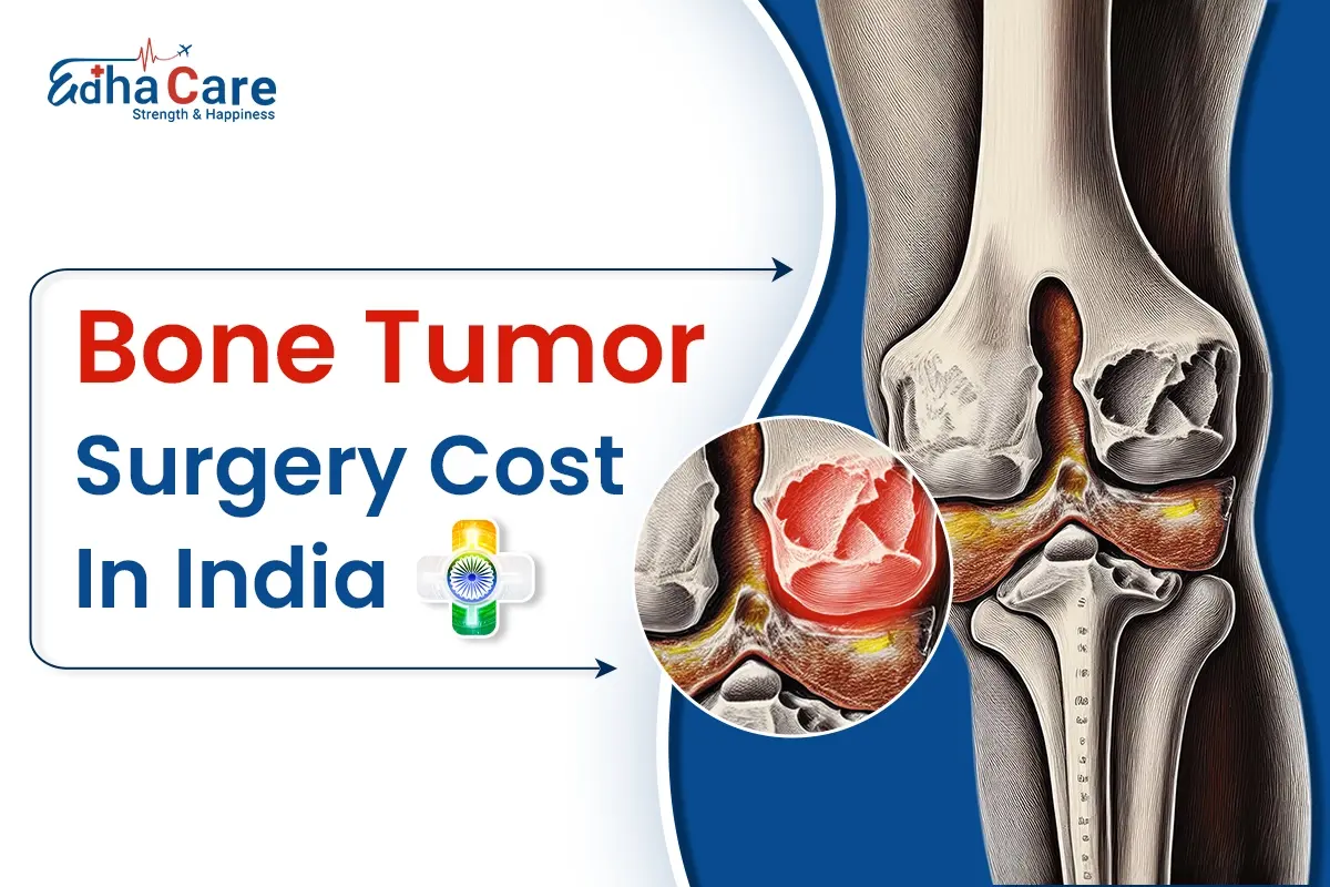 Bone Tumor Surgery Cost in India