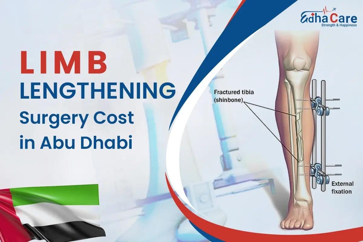 Limb Lengthening Surgery Cost in Abu Dhabi