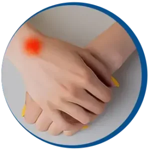 recovery post-lipoma removal