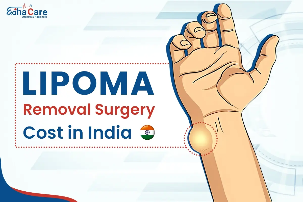 Lipoma Removal Surgery Cost in India