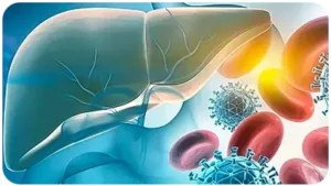 Liver transplant in Turkey