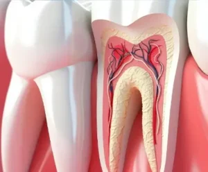 root canal treatment cost