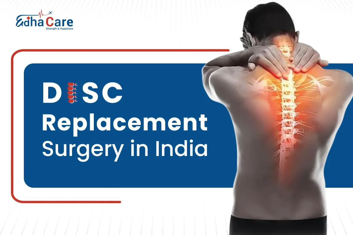 Disc Replacement Surgery in India