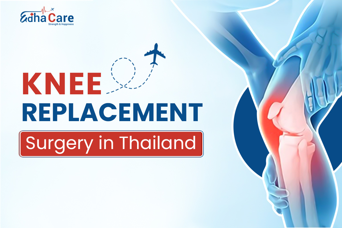 Knee Replacement Surgery in Thailand