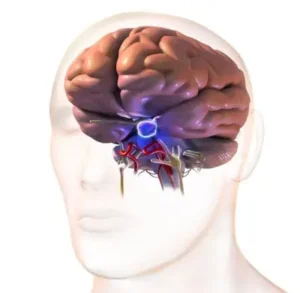 pituitary tumor 
