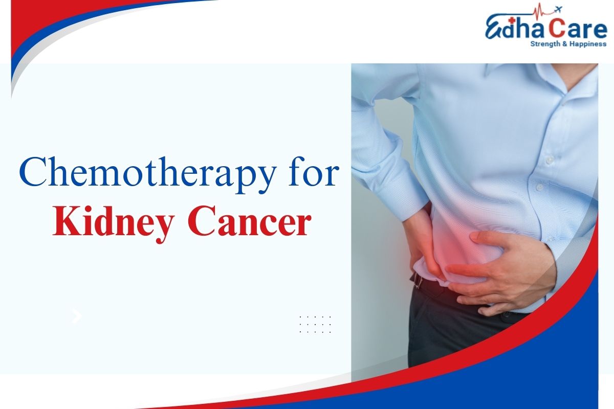 Quimioterapia para el cáncer de riñón