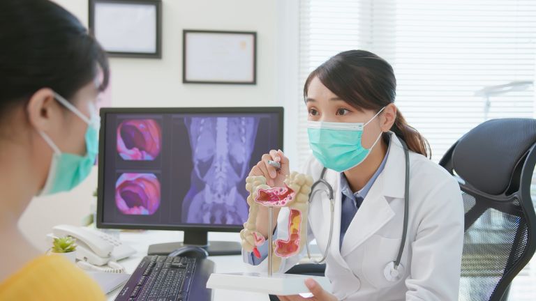 How I Knew I Had Colon Cancer?