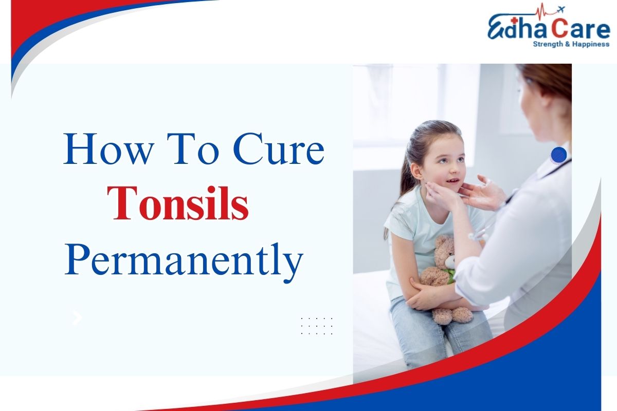 Jinsi ya kutibu tonsils kwa kudumu