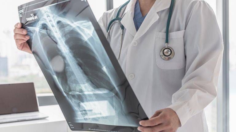 How Long Can You Have Bone Cancer Without Knowing