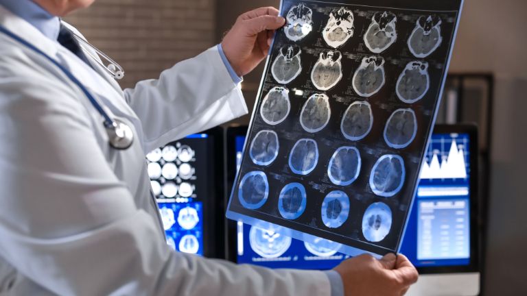 20 Best Neurologists in Lebanon