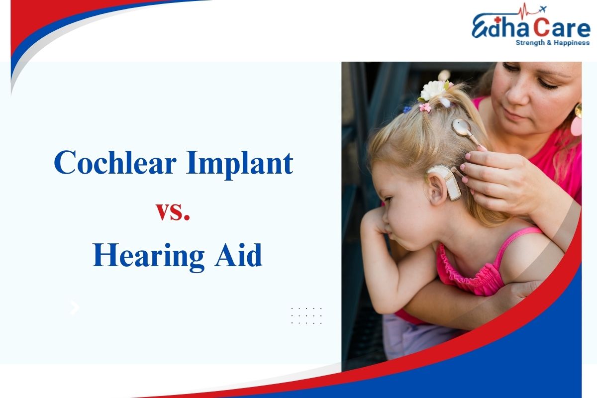 Cochlear Implant vs. Hearing Aid