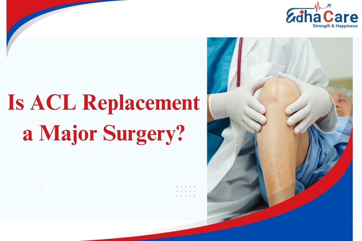ACL প্রতিস্থাপন কি একটি বড় সার্জারি?