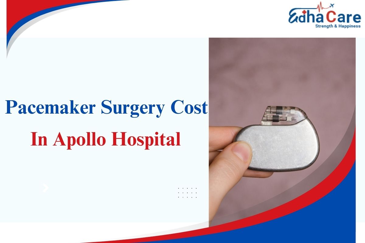 Costo de la cirugía de marcapasos en el Hospital Apollo