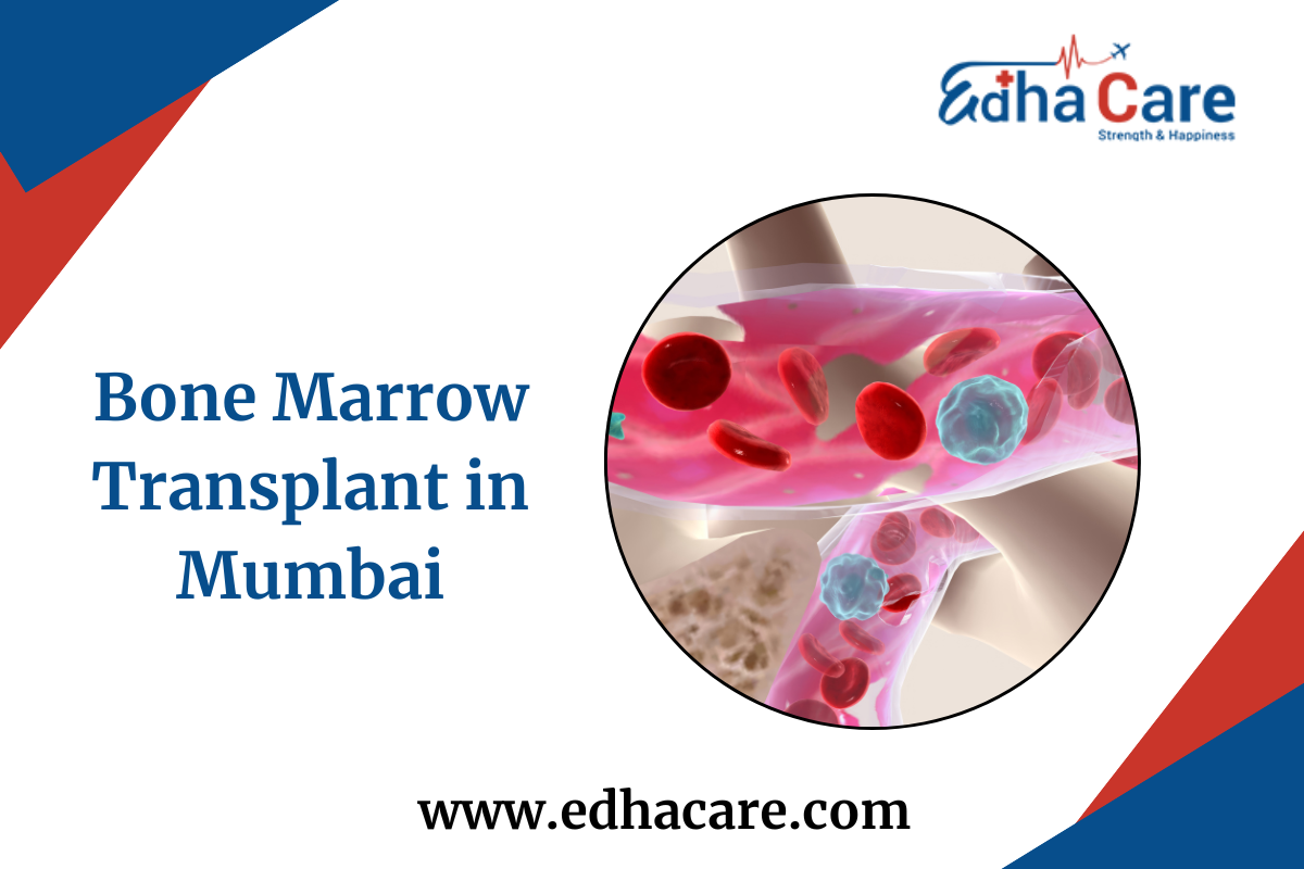 Bone Marrow Transplant in Mumbai