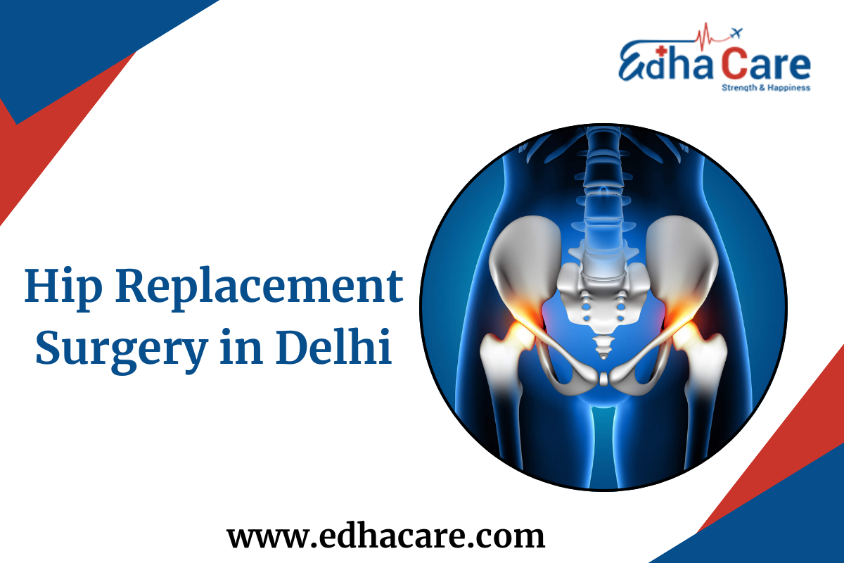 Hip Replacement Surgery in Delhi: Complete Details With Cost
