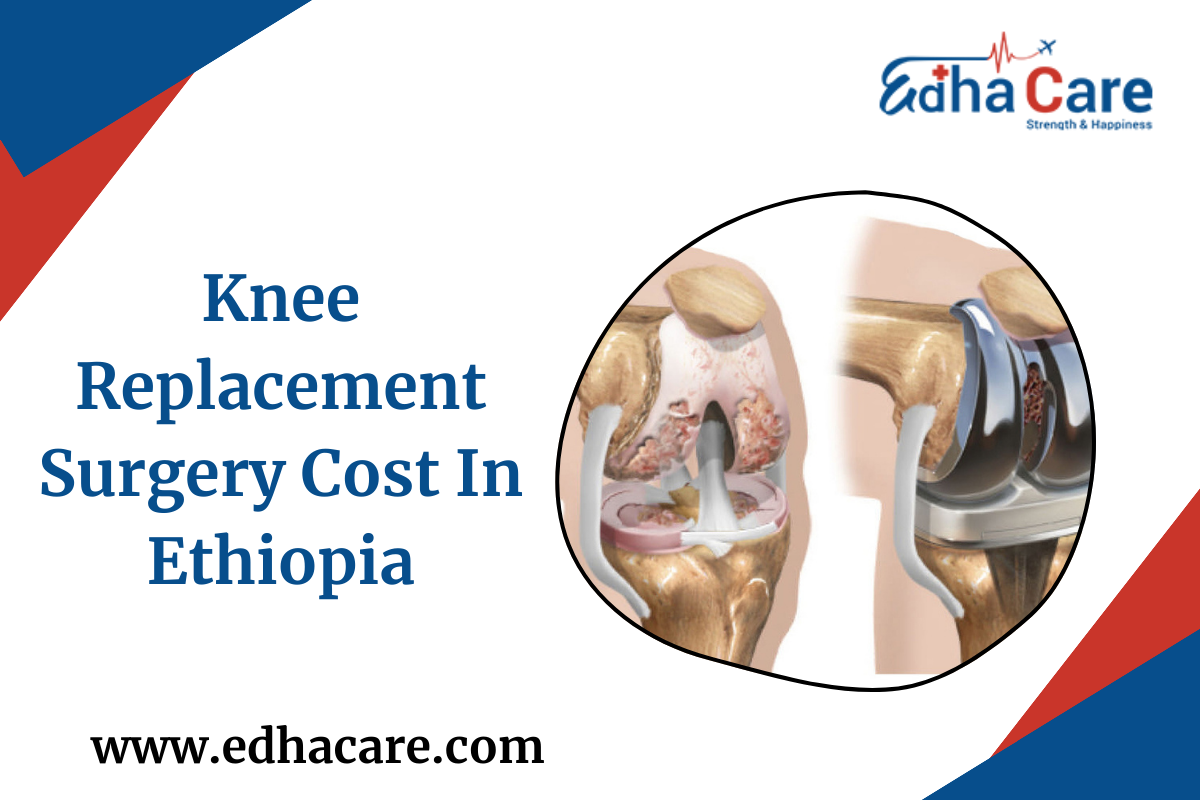 Knee Replacement Surgery Cost In Ethiopia