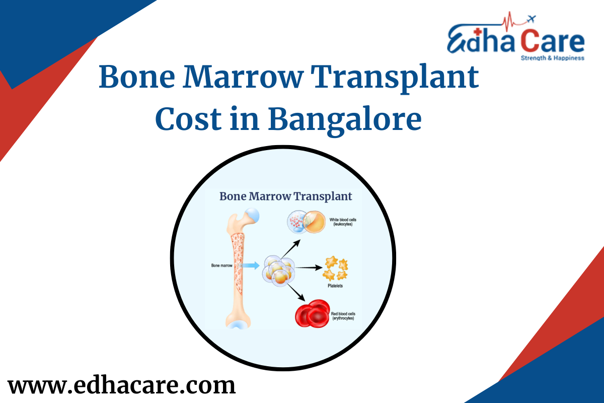 Bone Marrow Transplant Cost in Bangalore