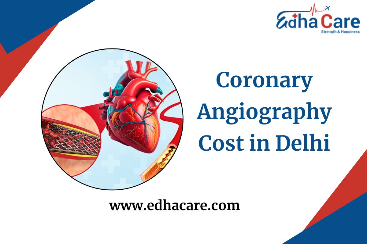 Análisis de precios estimados de la angiografía coronaria en Delhi
