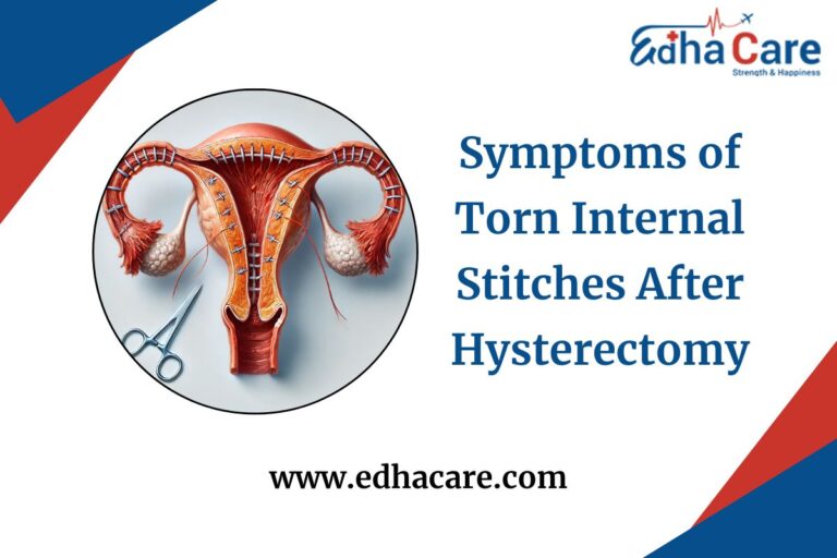 Symptoms Of Torn Internal Stitches After Hysterectomy
