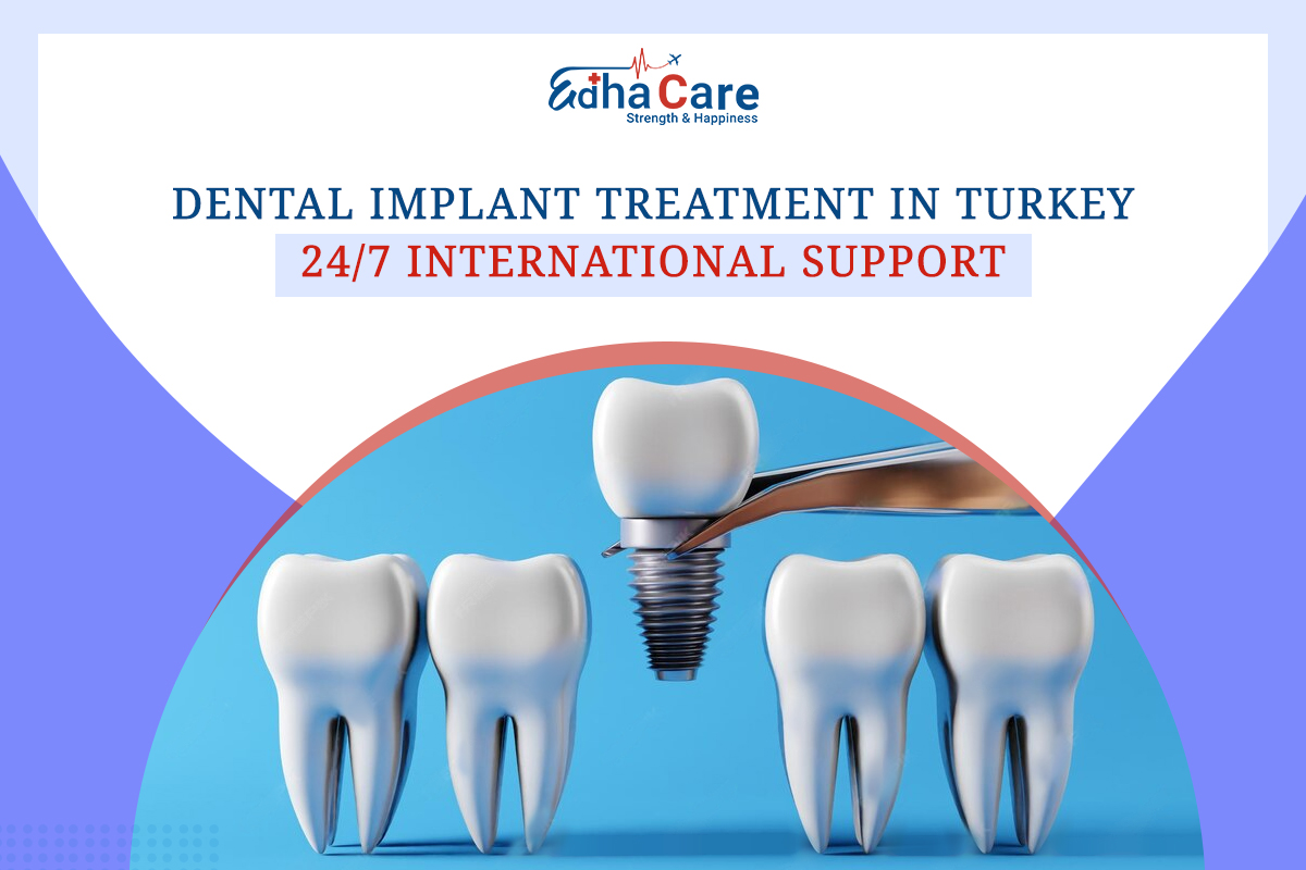 Dental Implant Treatment in Turkey: 24/7 International Support