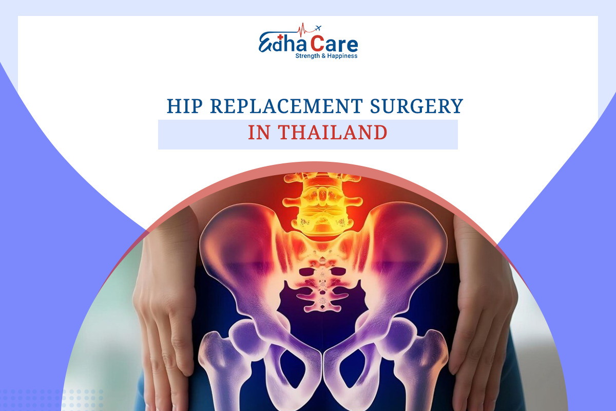 Hip Replacement Surgery in Thailand: Top Hospitals & Surgeons