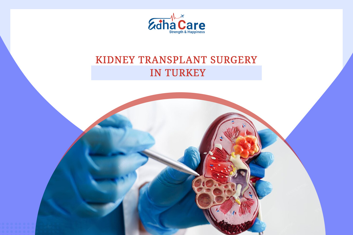 kidney transplant surgery in turkey