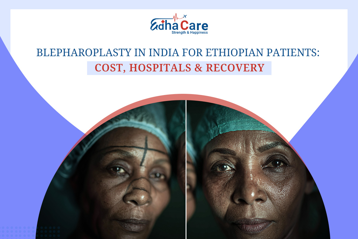 Blepharoplasty in India for Ethiopian Patients: Cost, Hospitals & Recovery