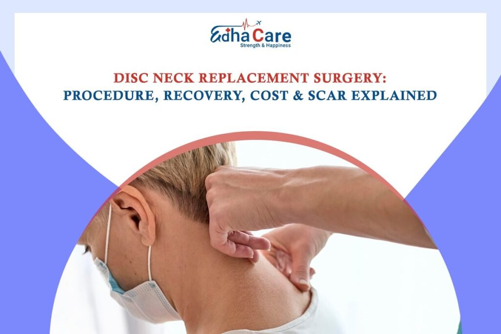 Disc Neck Replacement Surgery: Procedure, Recovery & Cost