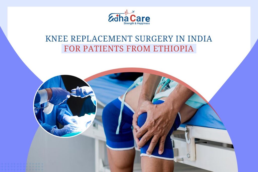 Knee Replacement Surgery in India for Patients from Ethiopia