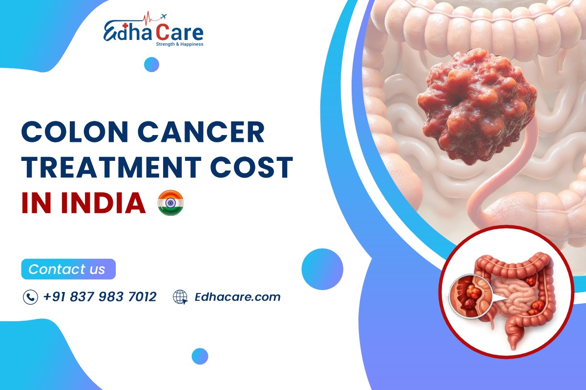 Colon Cancer Treatment Cost in India