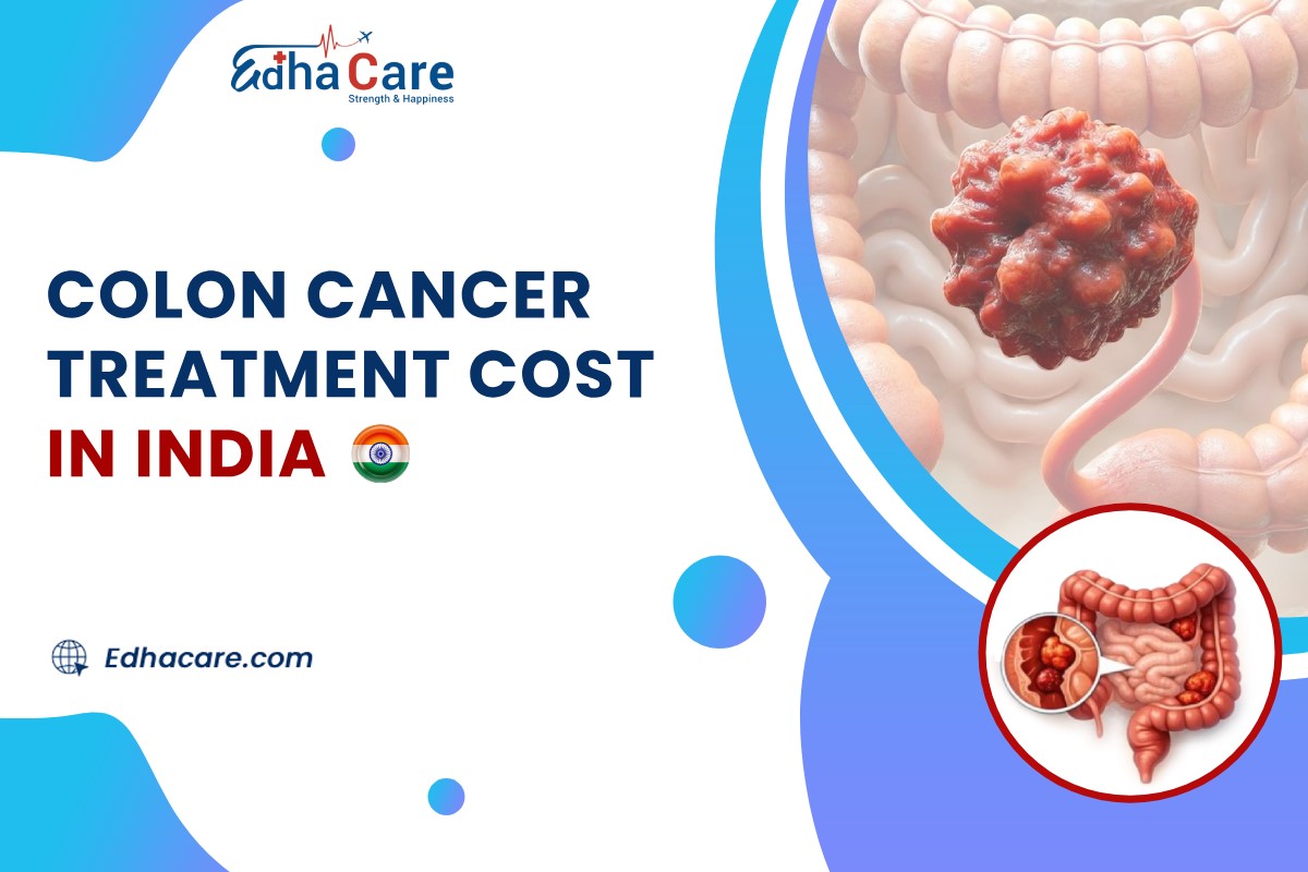 Colon Cancer Treatment Cost in India