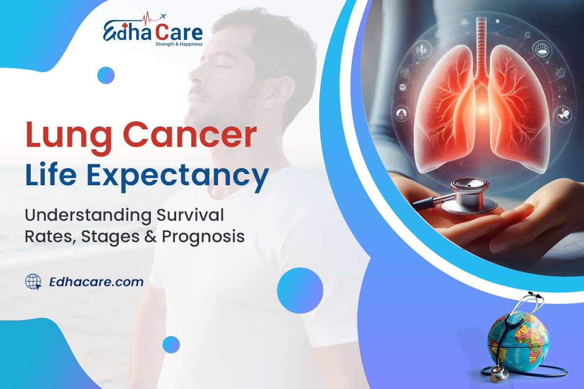 Lung Cancer Life Expectancy